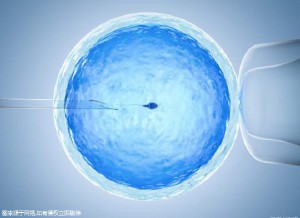 染色体易位
